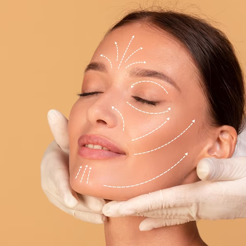 Face-Lift